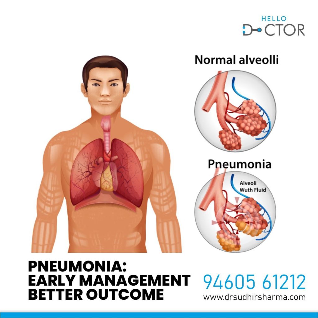 Pneumonia: Early Detection Can Save Lives, Especially for Seniors!