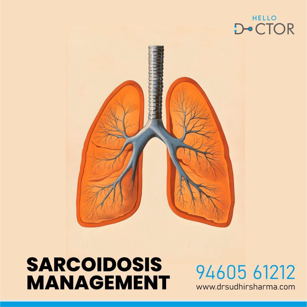 What is Sarcoidosis | How to Manage Sarcoidosis | Dr. Sudhir Sharma