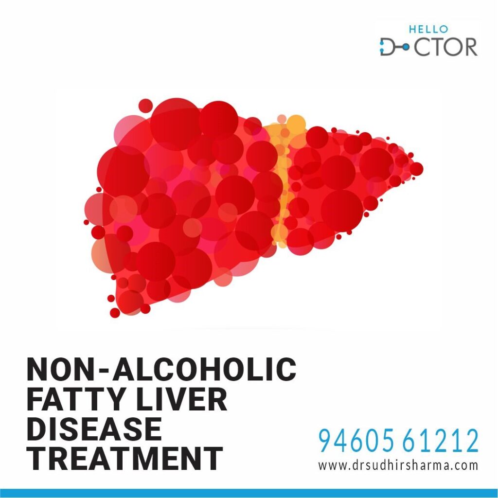 How to Treat Non-Alcoholic Fatty Liver Disease (NAFLD)