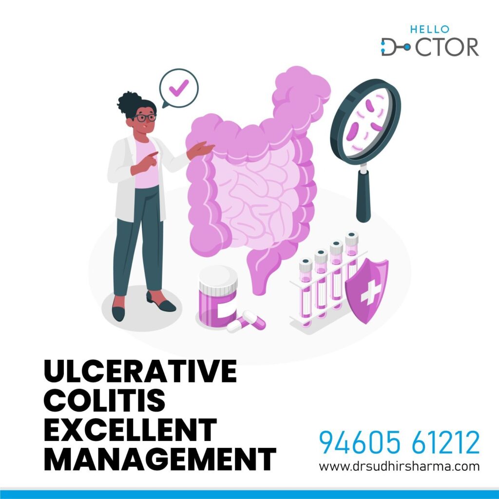 ulcerative colitis management